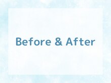 トリガー(TRIGGER)/Before & After