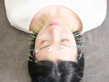 ラフテル鍼灸整骨院/美容鍼プレミアムコース♪