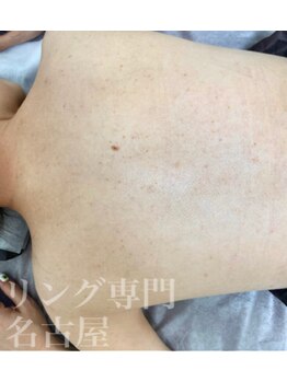 リベル 名古屋(Lebelle:)/ハーブピーリング専門名古屋