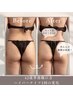 【人気No.1◆脂肪撃退】ハイパ-ナイフ+リンパ+detox70分￥16,500⇒￥11,000