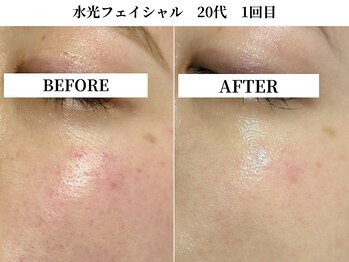 サンビ(SANBI)/小じわの原因は乾燥だった！