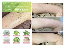 ルアナアイナ 池袋店(Luana Aina)の雰囲気（お顔・背中・二の腕・お尻など全身OK！[池袋/ハーブピーリング]）