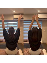 ココロ美容整体院(cocoro)/骨格調整BeforeAfter