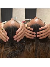 ルネアススパ 南青山(Lune’as Spa)/ドライヘッドスパ