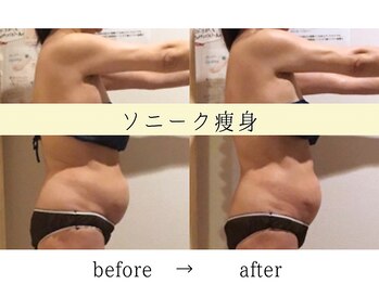 ボディデザインホームクレアフェリーチェ 神戸(Body design home Crea felice)/唯一無二☆業界初!ソニーク痩身
