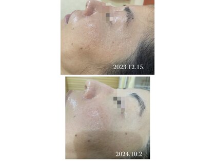 メリナ(Melina)の写真