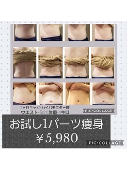 グランシェル(GRANSHEL)/