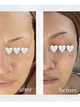 ポエマ(POEMA)/半年で、、、