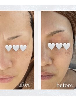 ポエマ(POEMA)/半年で、、、