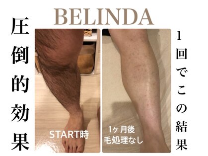 ベリンダ(BELINDA)の写真