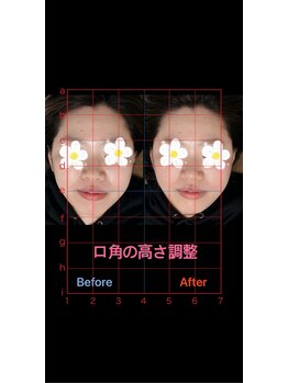 美容矯正サロン レレポノ(LELEPONO)/