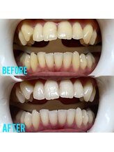 ホワイトニングセンター 沖縄コザ店/うるま市・沖縄市ホワイトニング