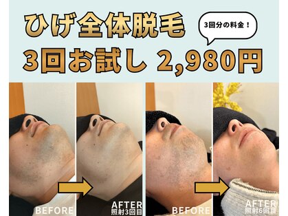 リズム(LISM)の写真