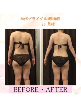 ビープロデュース 豊田店(B'PRODUCE)/ブライダル