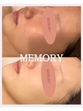 メモリー(MEMORY)/お悩みが改善し陶器肌へ♪