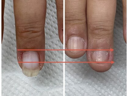 ブルームーンネイルズ(BLOOMOON.nails)の写真