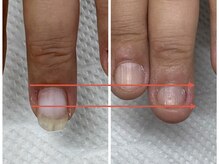 ブルームーンネイルズ(BLOOMOON.nails)