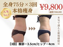 クレビア(Clevia)