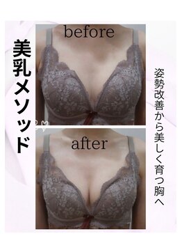 リヴェーヌ 呉羽店(Riverne)の写真/【当店人気No.1】富山市にあるエステサロンで叶う♪ボディラインからチェンジ！サイズや下垂や離れ乳悩みも