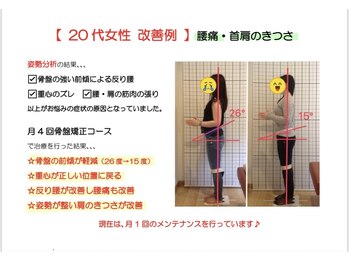 モア整体院 メディカルボディーメイク(Medical body make)/症状改善例です