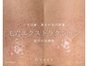 【毛穴の大掃除☆ザラザラ→ツルツル肌に♪】毛穴エクストラクション60分