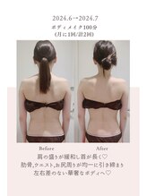 トゥインクル 麻布(twinkle)/南麻布/勝山式美容矯正/小顔矯正