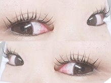 プラチナム(Platinum)/