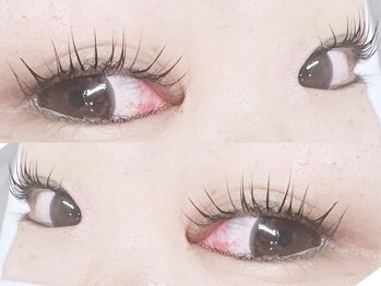 プラチナム(Platinum)/