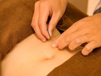 エクステンド鍼灸整体院(extend鍼灸整体院)/本治