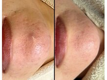 ワイケー(yk)/プラズマ♪