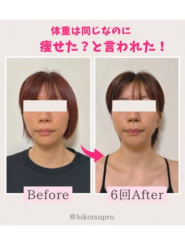 ビコツプロ(Bikotsu Pro)/トータル美骨3ヶ月６回の変化