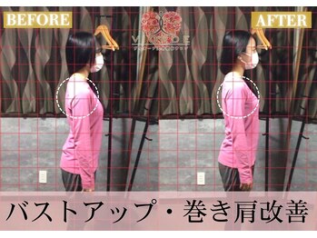 ヴィオーデ 船橋店/小顔、リンパ、ヘッドスパ、骨盤