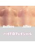 【毛穴つるぴかゴワつき改善】ハイドロフェイシャル　¥7000