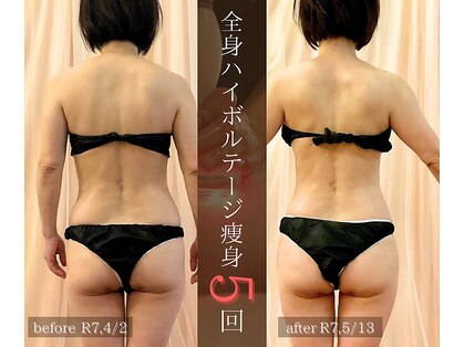 ツルル 岡崎店(TSURURU)の写真