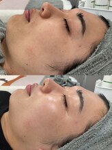 リリーラボ(LILY LAB)/【BIOPHYTO/ビオフィート】