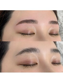 リモアプラス(REMORE+)/ブロウリフト