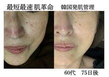 シェリートーキョー 成田店(Cherie Tokyo)