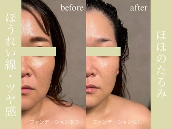 健志接骨院/πテラピー造顔メソッド