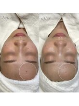 サロンドシェフィア(Salon de Chefia)/Salon de Chefia | 症例写真