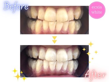 ルルネイル(Lulu Nail)/月一万円で通い放題