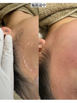 モンクラッシー(Mon classy)/もみあげまで整えます