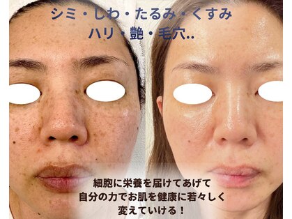 ワッカ(wacca)の写真