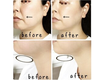 リムー(RE@Muu)の写真/【9時~営業】メンズ.ペアOK!隅々までこだわり抜いた上質空間で贅沢なひとときを♪大型店が苦手な方にも◎