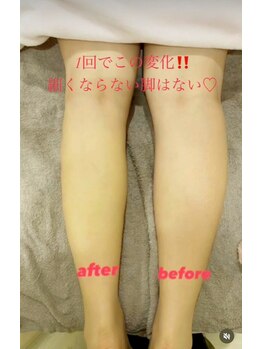 メディカルエステ 大宮店/痩身/痩身/痩身/痩身/痩身/痩身/