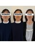 【平日限定】顔のもたつき・たるみが気になる方へ　小顔ケア60分　￥9,800