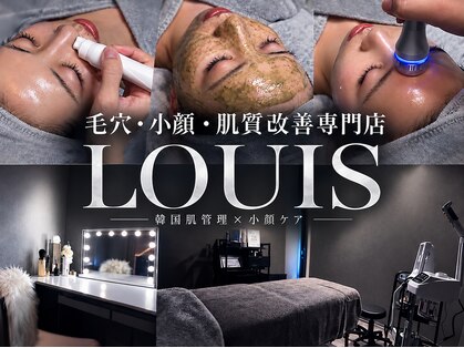 ルイス(LOUIS)の写真