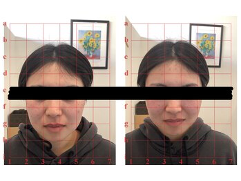 田端整体院/頬が引き締まる小顔整体