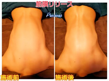 プレシャス(Precious)の写真