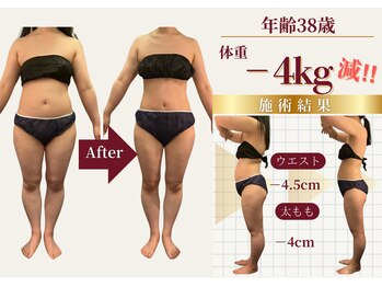 ザ ラウラ ビューティー ボディ(THE LAULA BEAUTY)/38歳【ボディメイク】