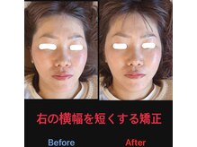 美容矯正サロン レレポノ(LELEPONO)/